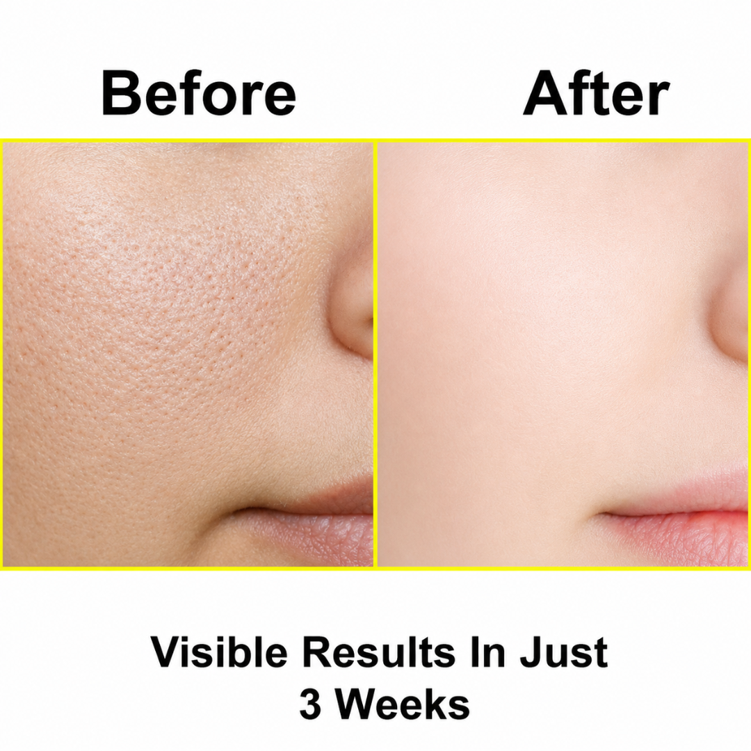 OPLUX Niacinamide Serum (30ml)